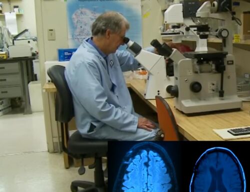 Onderzoekers onderzoeken cannabisverbindingen voor de behandeling van dementie (video)